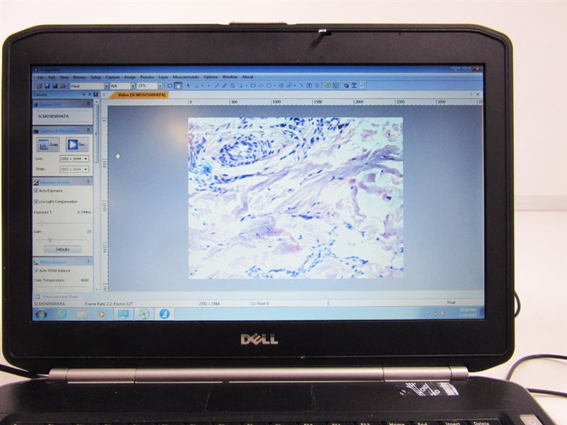 Olympus CK2 Phase Contrast Microscope w/ Computer & Imaging Software